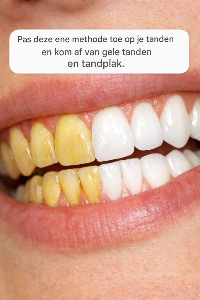Pas deze ene methode toe op je tanden en kom af van gele tanden en tandplak.
