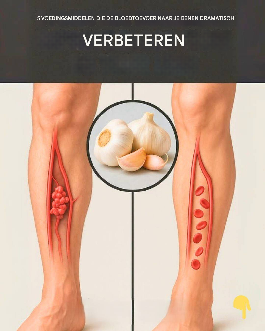 5 voedingsmiddelen die de bloedtoevoer naar je benen aanzienlijk verbeteren