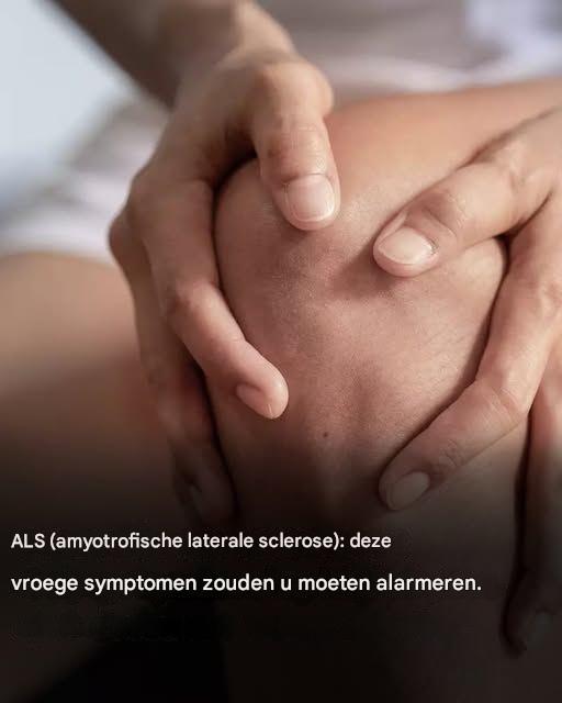 ALS (amyotrofische laterale sclerose): Dit zijn de eerste symptomen van deze ziekte.