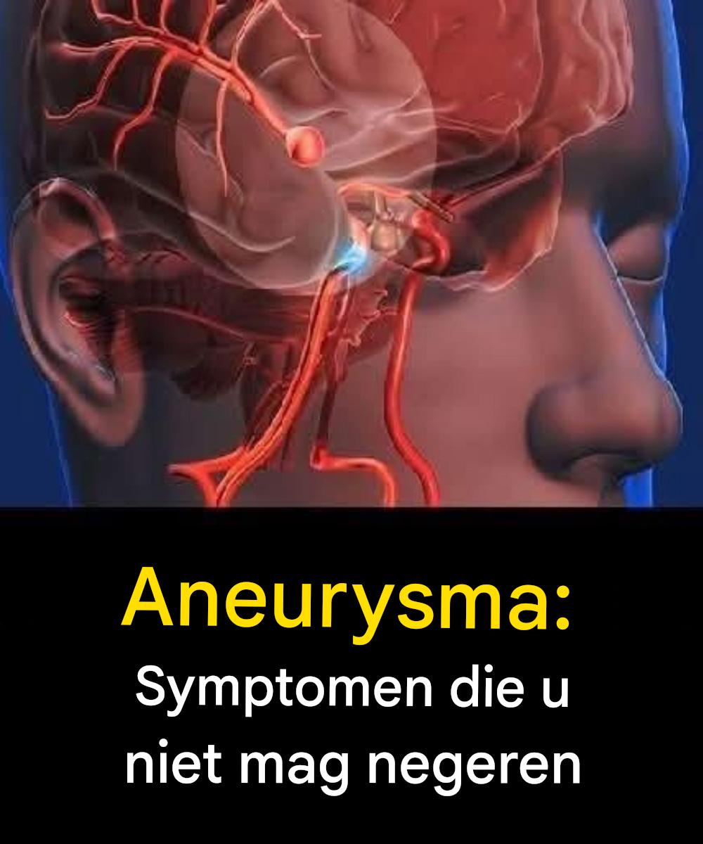 Aneurysma: signalen die u niet mag negeren…