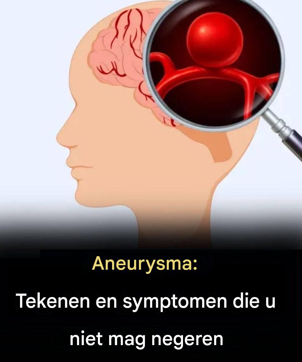 Stille aneurysma’s: waarom sommige hersenaandoeningen onopgemerkt blijven