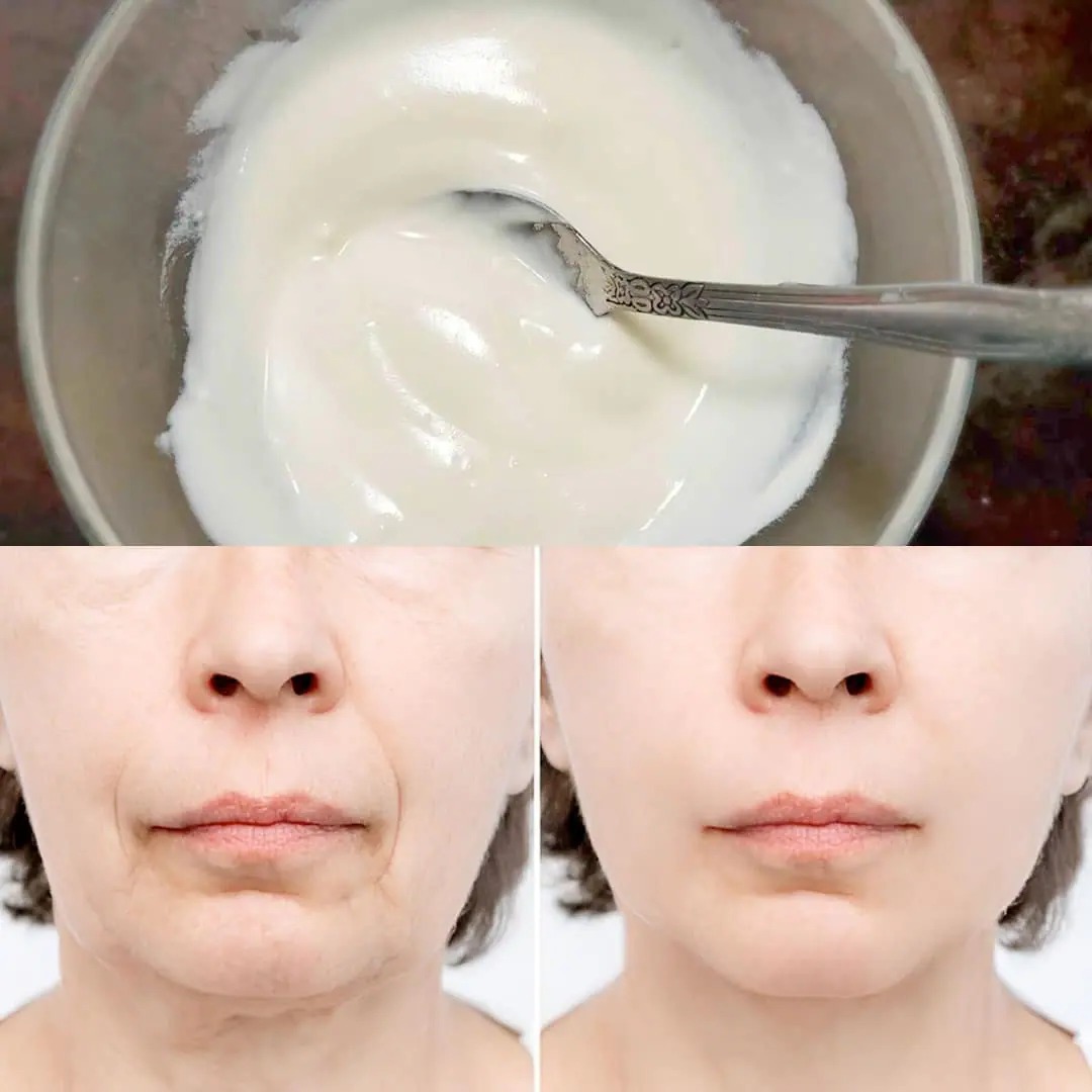 Zuiveringszout: een natuurlijke crème die rimpels en oneffenheden in het gezicht verwijdert.